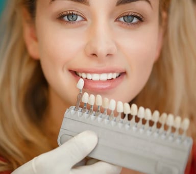 Smiling woman showing dental shade guide for teeth