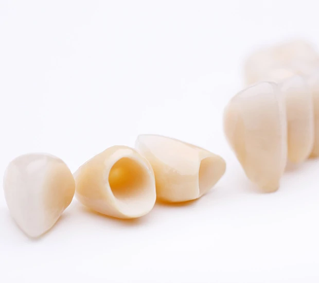 Dental crowns arranged on a white background.