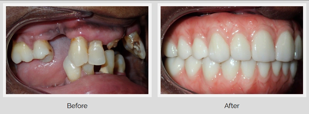 Comparison of dental treatment before and after.